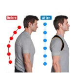 Posture Corrector